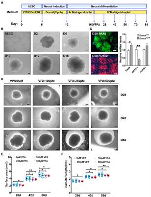 Valproic acid exposure decreases neurogenic potential of outer radial glia in human brain organoids